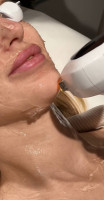 Lumecca® - LUMECCA-NO-FOUNDATION